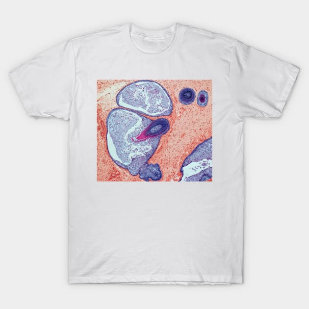 Dermoid ovarian cyst, light micrograph (C019/9256) T-Shirt by SciencePhoto